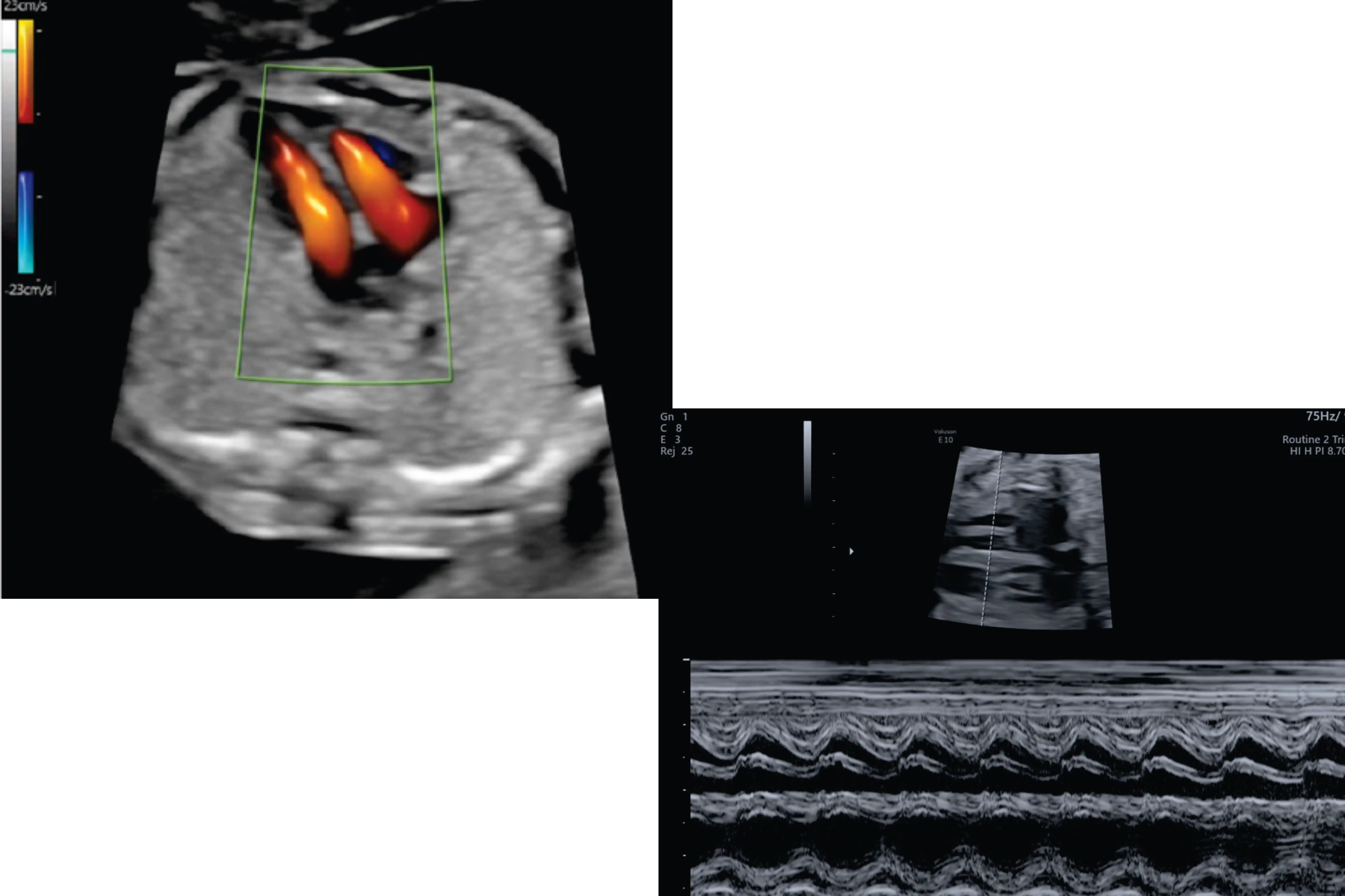 Fetal Heart - from Womb to Cradle